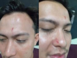 Kasus Pengeroyokan Di Talang Jimar,Korban Minta CCTV Diungkap